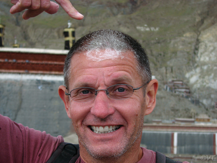 Yakboter helpt erg goed tegen zwelling na een gestoten hoofd